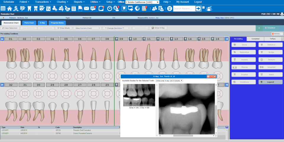 Denticon